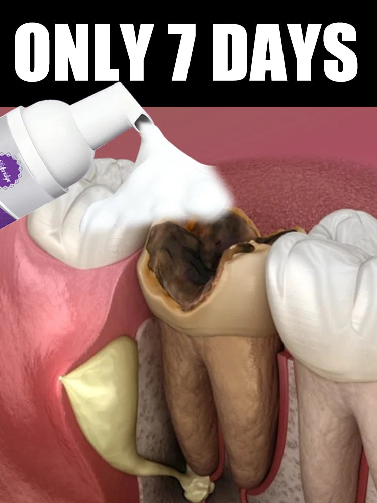 Tidesmit oral foam teeth whitening and cleaning kit for professional dental care