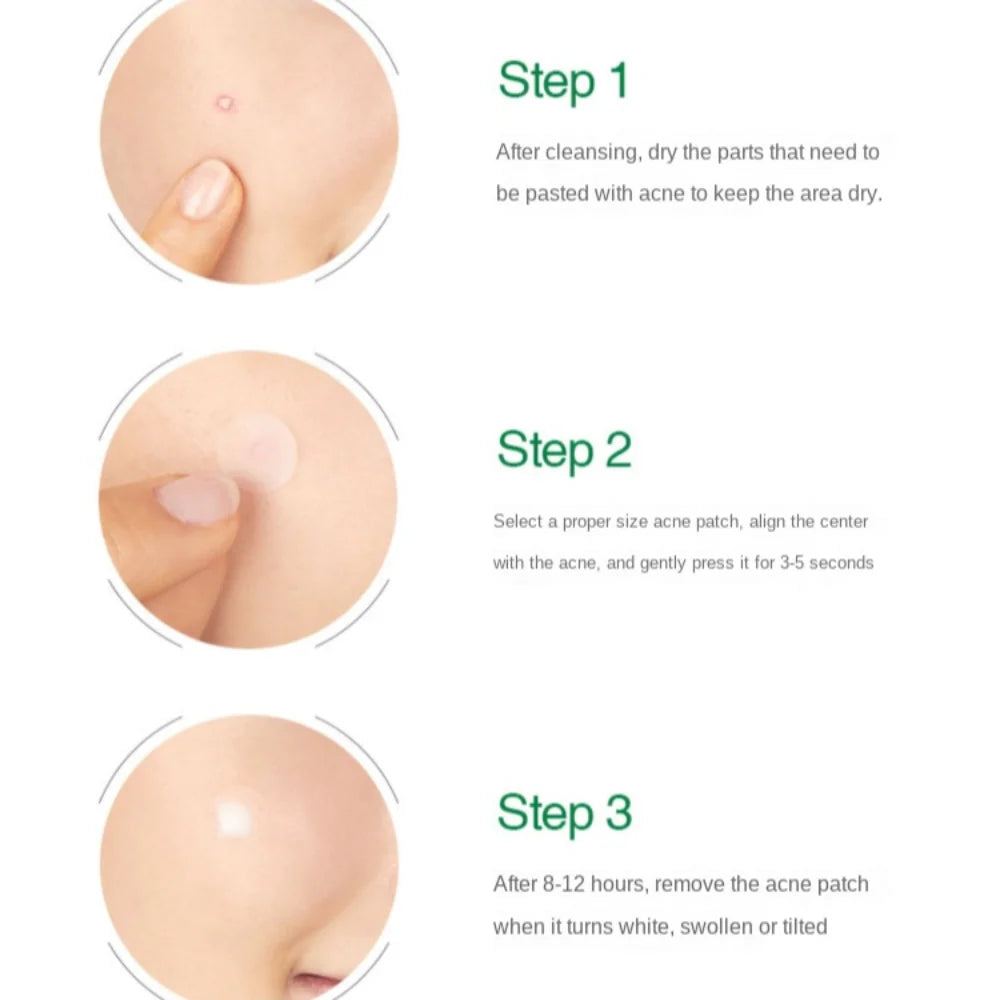 Artificial Skin Acne Removal Patch Invisible Beauty Stickers Pimple Patch Concealer Absorbing Liquid Acne Cleansing Patch
