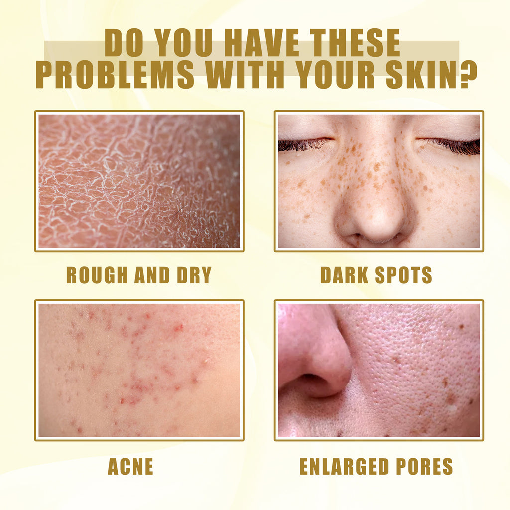 Yellow Peeling Oil for Dark Spots - Exfoliating Serum 50ml-150ml Scrubs Treatments Tidesmit
