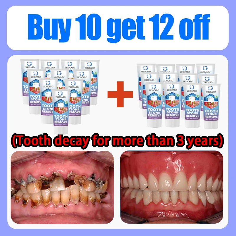 Tooth Decay Repair Treatment | Natural Mineral Enamel Gel | Tidesmit Scrubs Treatments Buy 10 Get 12 Free Tidesmit