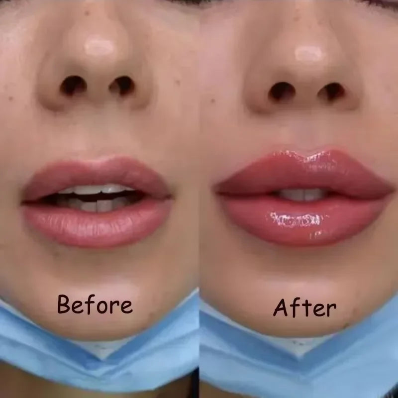 Lip Plumper Oil – Hydrating Serum for Fuller Lips – Cruelty-Free Lip Care Lip Care Tidesmit