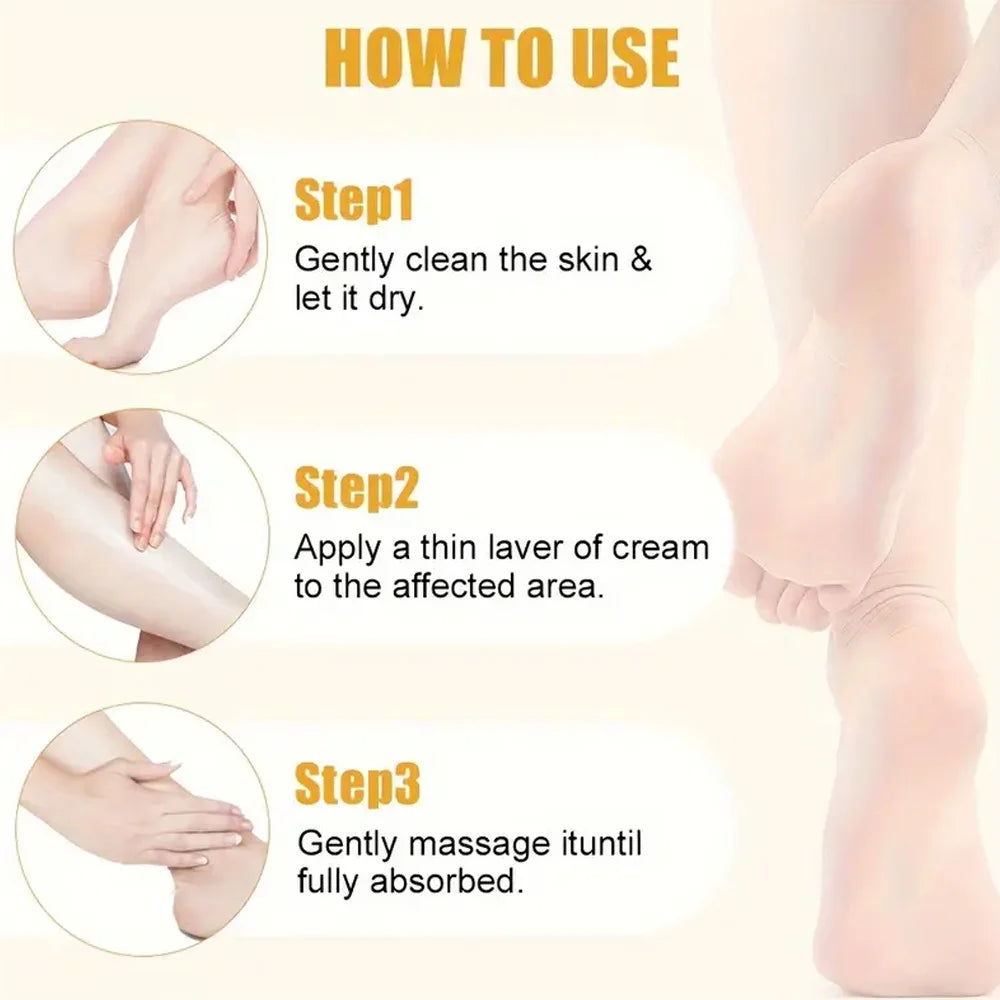 Urea 40% Cream for Cracked Heels and Dry Skin Repair - Tidesmit Scrubs Treatments Tidesmit