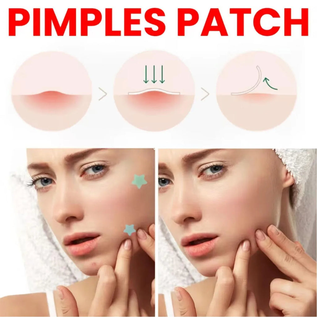 200/1000PCS Acne Patch Water Colloidal Patch Acne Patch Covering Facial Flaws Ultra Thin Invisible Suitable For All Skin Types