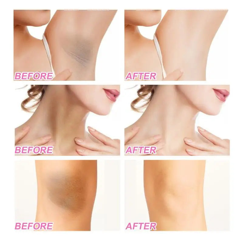 Body Whitening Niacinamide Brighten Cream For Intimate Parts Underarm Bleach Knees Lighten Thigh Inner Korean Skin Care Products