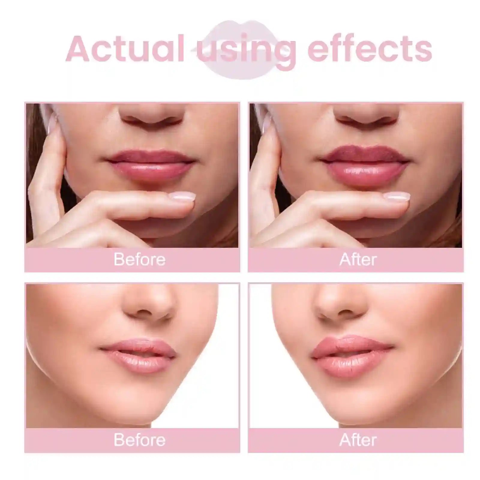 Volumizing Lip Serum: Hydrating Plumper for Fuller, Nourished Lips Lip Care Tidesmit