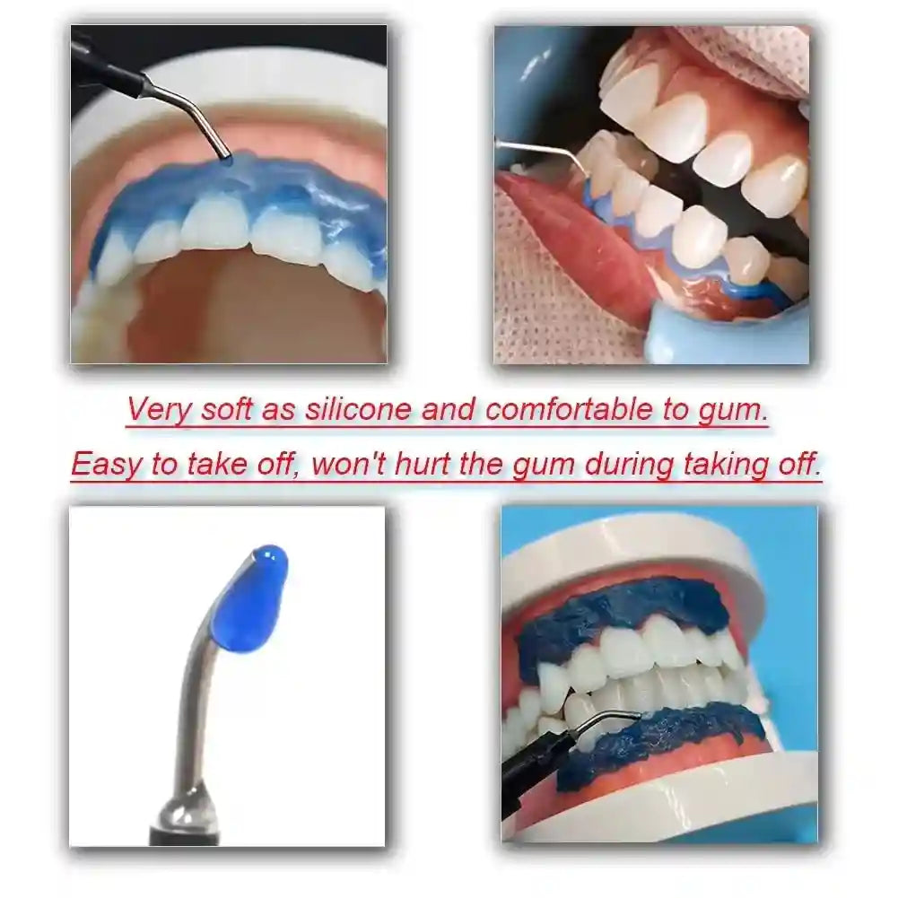 Gingival Barrier Gel for Professional Teeth Whitening - 5PCS Set Lip Care Tidesmit