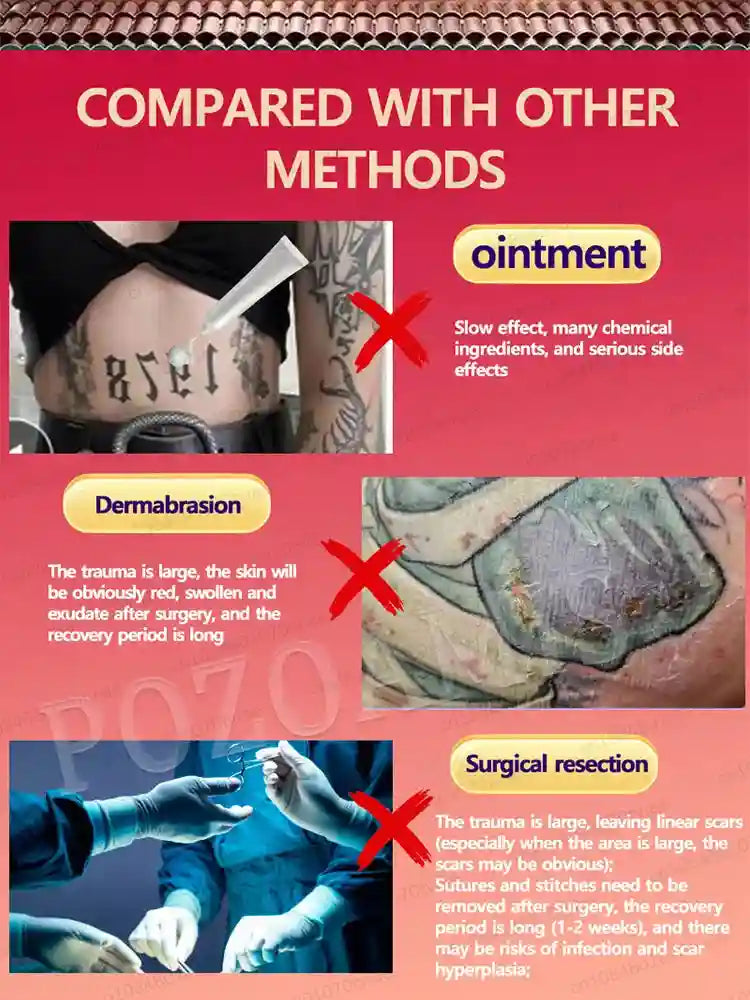Tattoo Removal Cream for Body and Face - Professional Fast Action Formula Scrubs Treatments Tidesmit