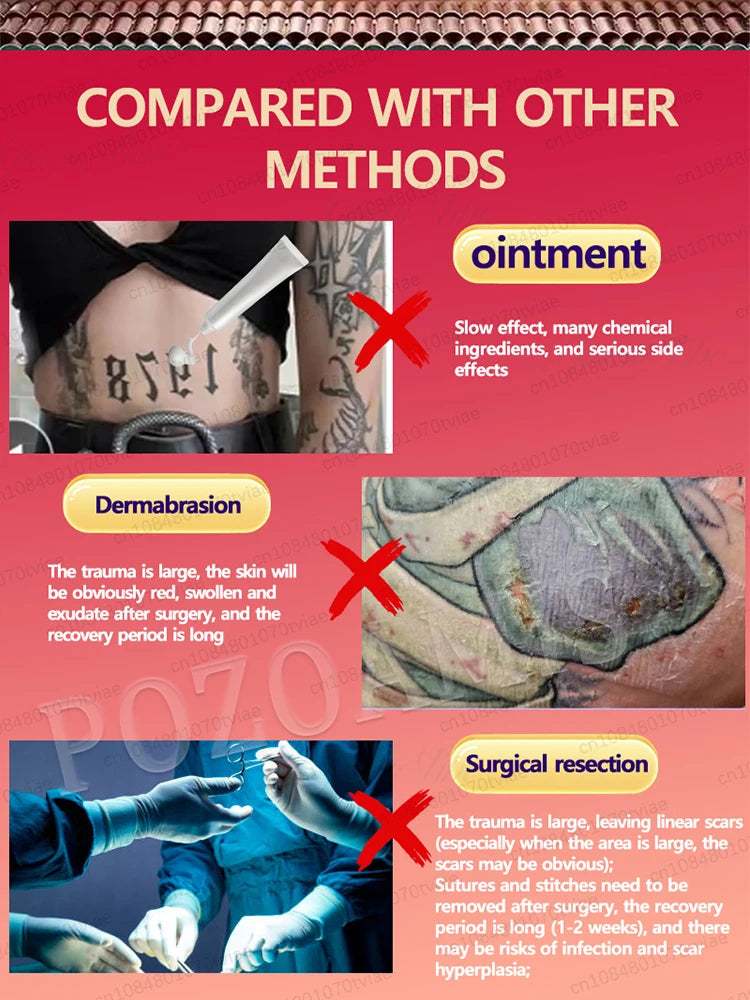 Nano Laser Tattoo Removal Solution | Professional Ink Eraser - Tidesmit Scrubs Treatments Tidesmit