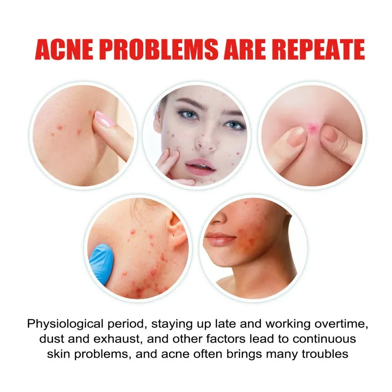 200/400pcs Acne Patches Invisible Pimple Cover for Face Oil Control Spot Treatment Cute Sticker for Covering Zits and Blemishes