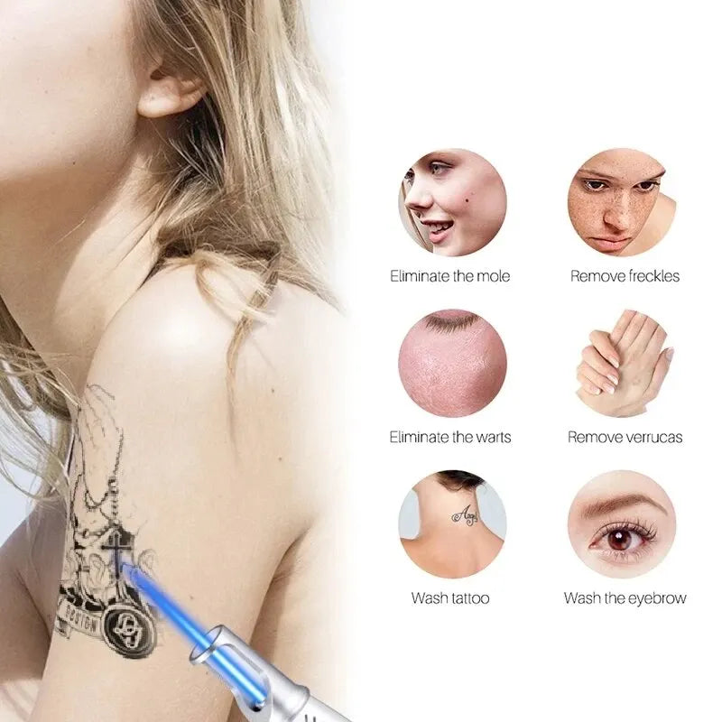 Picosecond Laser Pen for Dark Spot Removal - Portable PMU Machine Permanent Makeup Machines Tidesmit
