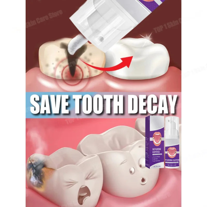 Tidesmit teeth whitening and cavity repair kit for plaque removal and dental enamel protection
