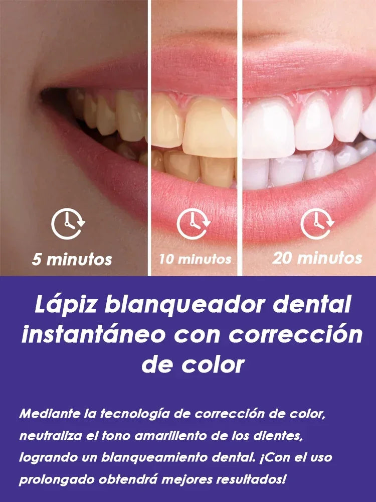 Teeth Whitening Pen for Sensitive Teeth | Gentle Stain Remover Lip Care Tidesmit