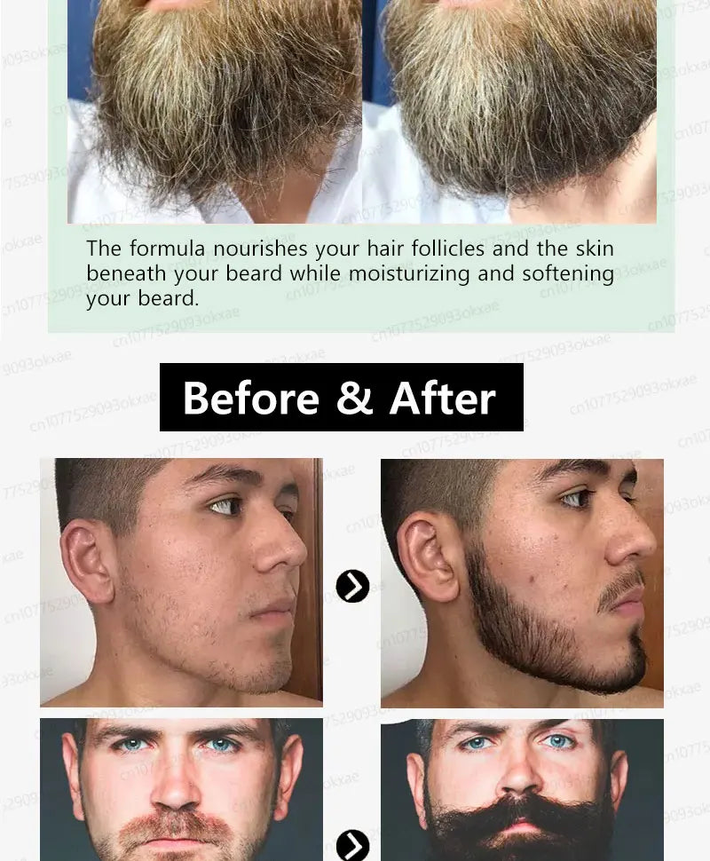 Beard Growth Essence for Thicker Facial Hair - Natural Formula Relaxation Treatment Tidesmit