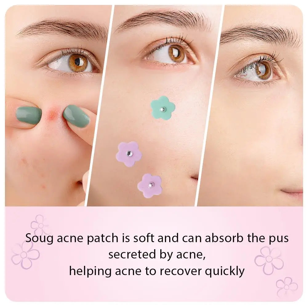 20/60pcs Hydrocolloid Acne Patches Flower Shape Pimple Patch For Face Spot Treatment Stickers For Overnight Makeup
