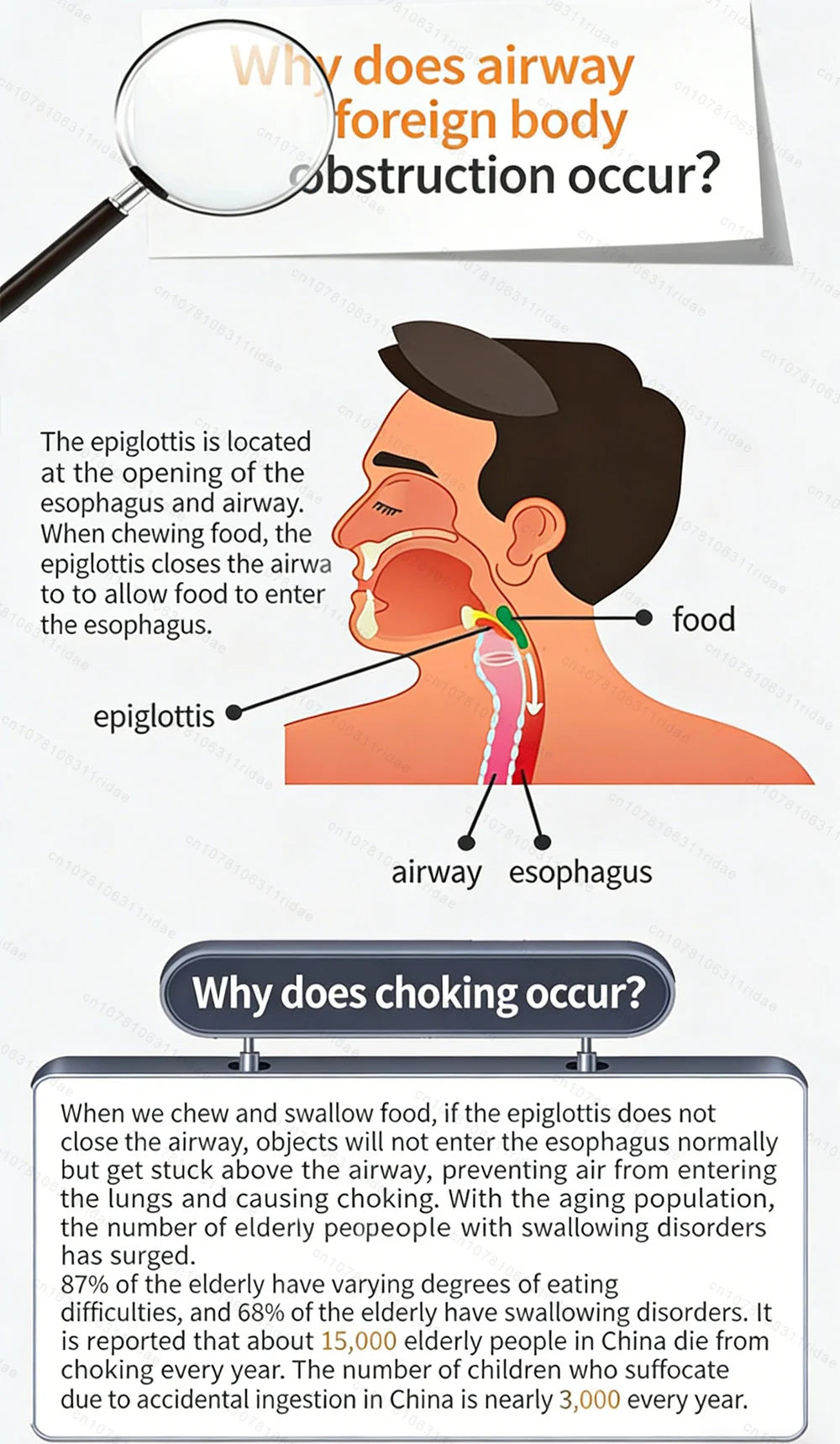 Choking Rescue Device | Manual Anti-Asphyxia Tool | Blue Tidesmit Relaxation Treatment Tidesmit