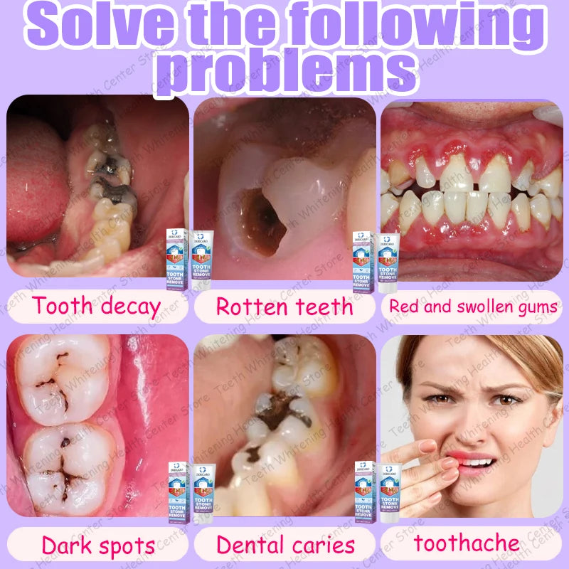 Tooth Decay Repair Treatment | Natural Deep Cleaning & Restorative Formula Scrubs Treatments Tidesmit