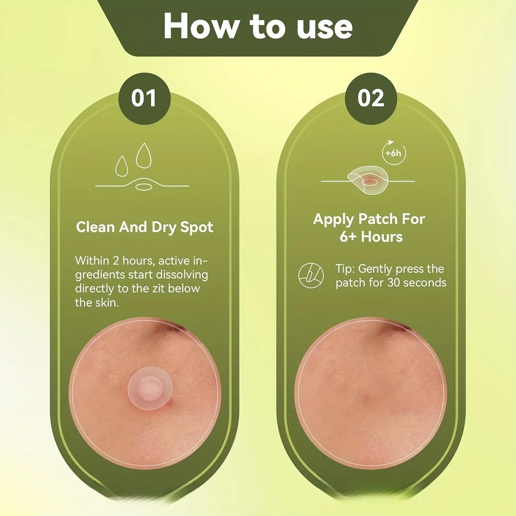 9 pieces water-based acne patches, invisible and comfortable acne patches, with micro needle tips, suitable for early acne