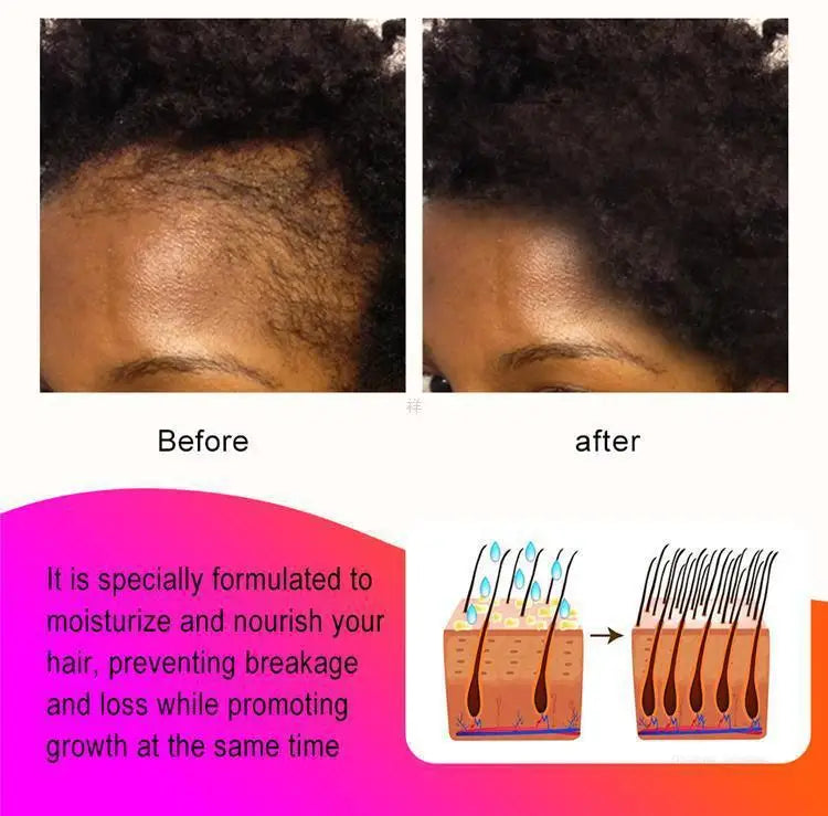 Tidesmit hair growth oil spray for traction alopecia, repairing hair roots to prevent loss and promote regrowth results.