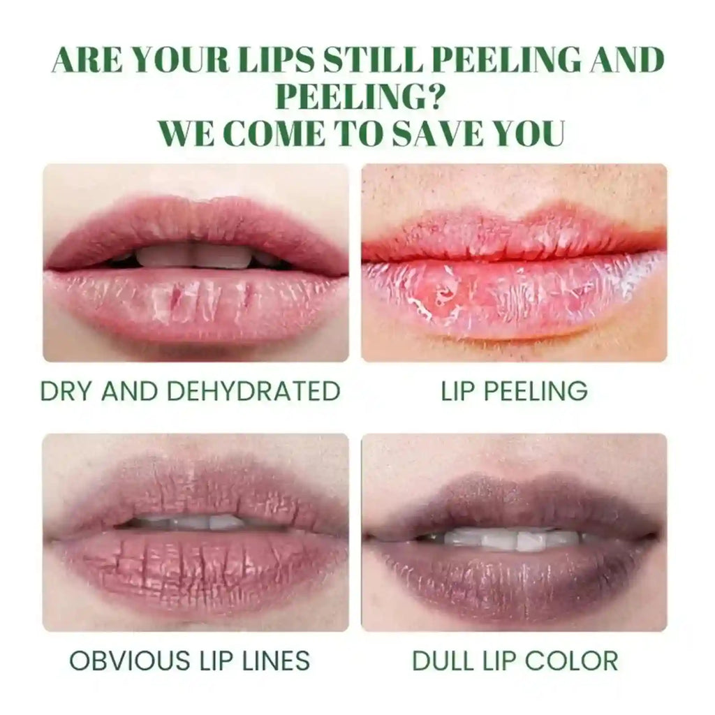 Dark Lip Lightening Balm – Moisturizing Exfoliating Lip Treatment Lip Care Tidesmit