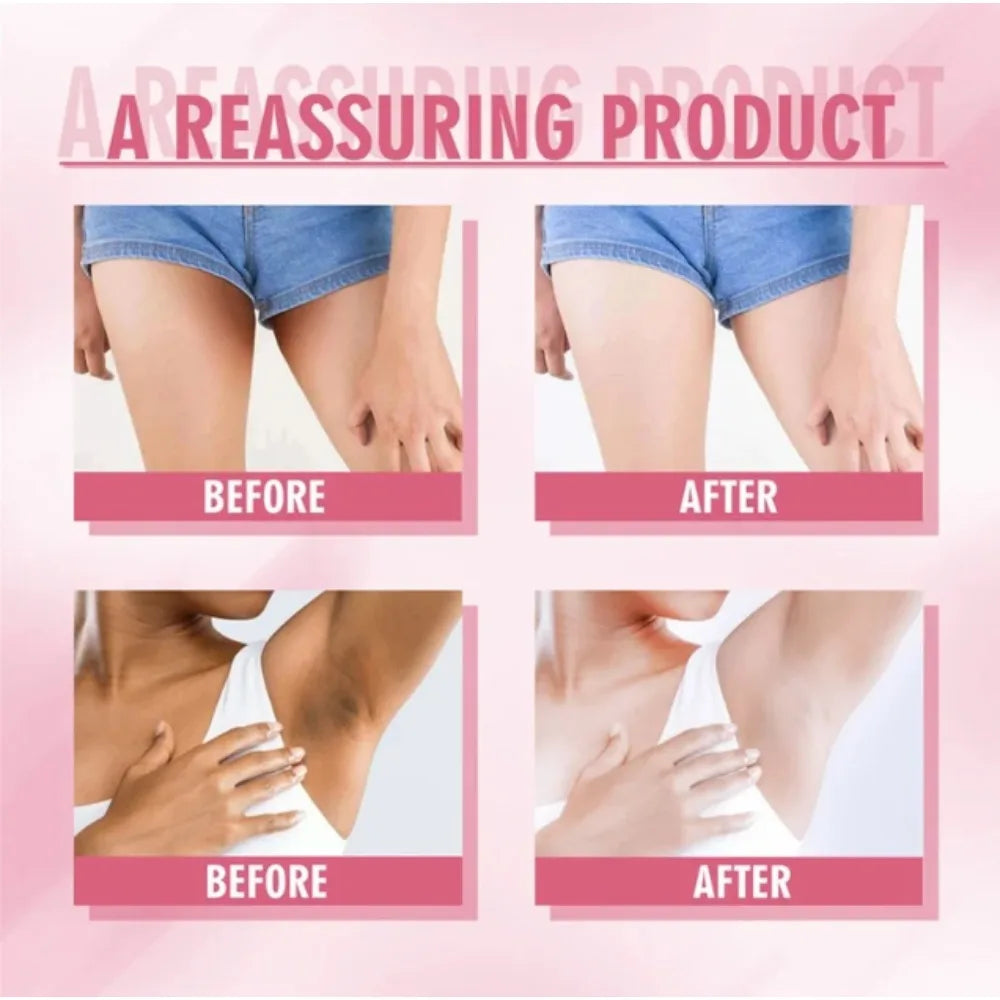 Niacinamide Body Whitening Cream For Underarm Bleaching Armpit Lightening Intimate Area Moisturizer Korean Skin Care Product