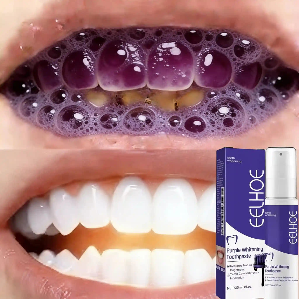 Tidesmit whitening toothpaste for yellow teeth removal and professional oral hygiene cleaning