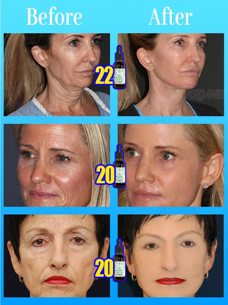 Tidesmit anti-aging serum before and after results showing wrinkle reduction and smooth, youthful skin texture.