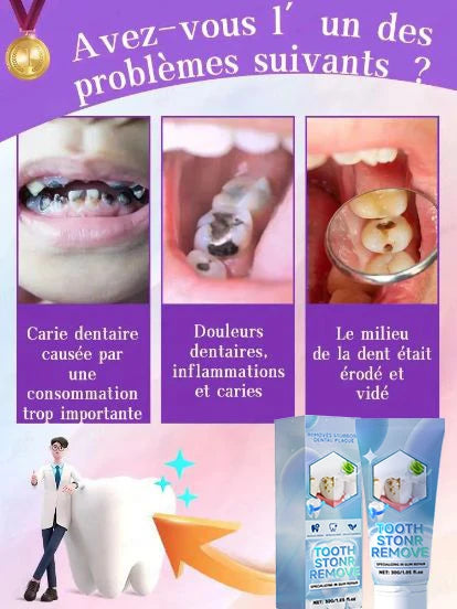 Tidesmit probiotic teeth whitening treatment for tooth decay repair and deep enamel cleaning