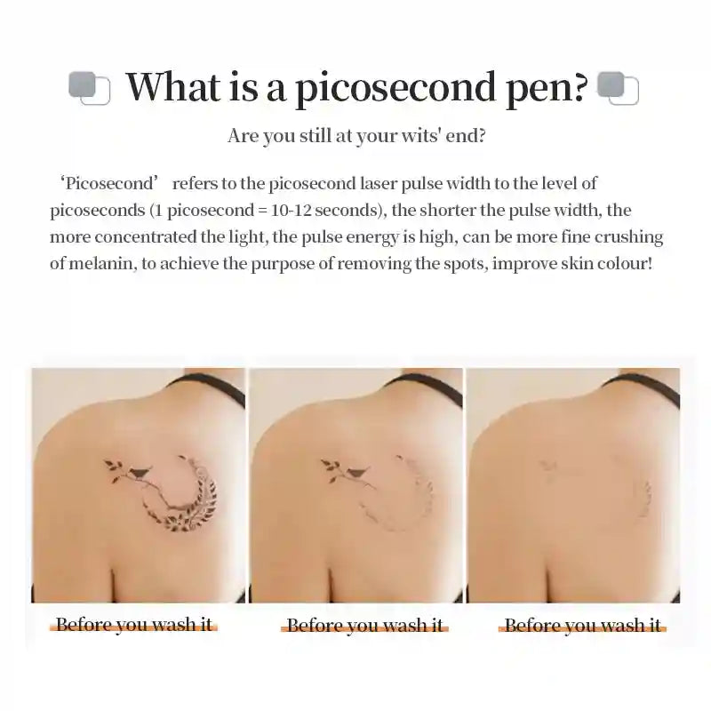Picosecond Laser Pen for Dark Spot Removal - Portable Skincare Device Eye Massage Instrument Tidesmit