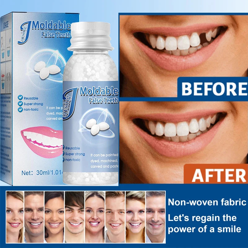 Temporary Tooth Repair Beads | Food Grade Dental Filling Material for Missing Broken Teeth, Denture Adhesive Solid Glue