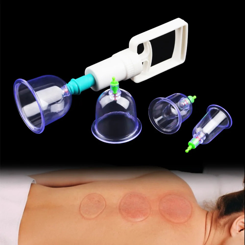 Vacuum Cupping Set for Deep Tissue Muscle Relief - 6 or 12 Piece Kit Body Shaping Massage Equipment Tidesmit
