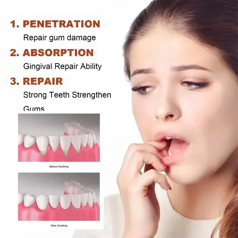 Tidesmit Rapid Repair Gum Serum for teeth whitening and relief of tooth sensitivity and dental damage