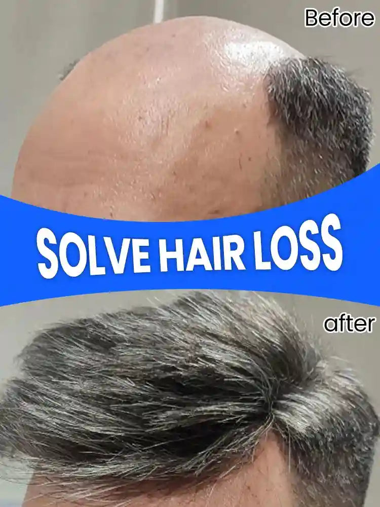 Scalp Massage Roller for Hair Growth - Stimulating Wellness Tool Massage Roller Tidesmit