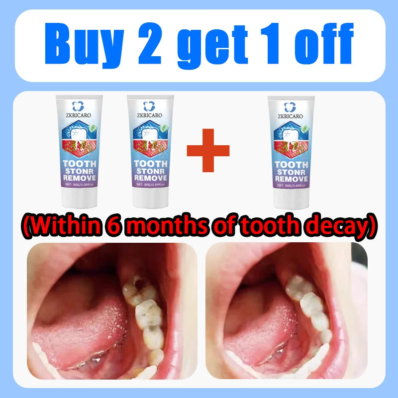 Teeth Whitening Scrub Paste | Deep Cleaning Dental Treatment Scrubs Treatments Buy 2 Get 1 Free Tidesmit
