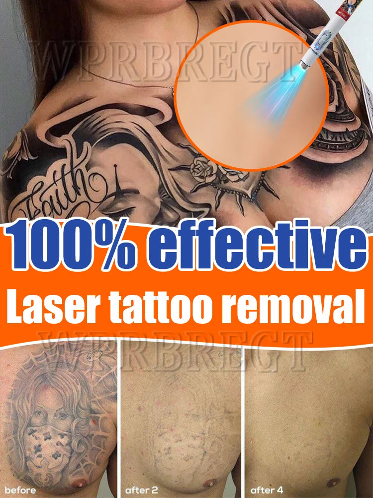 Nano Laser Tattoo Removal Solution | Professional Ink Eraser - Tidesmit Scrubs Treatments Tidesmit