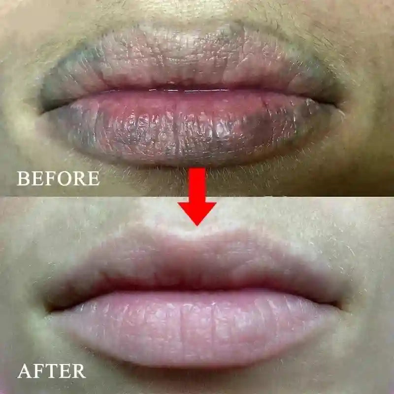 Dark Lip Moisturizing Balm - Targeted Melanin & Line Treatment Lip Care Tidesmit