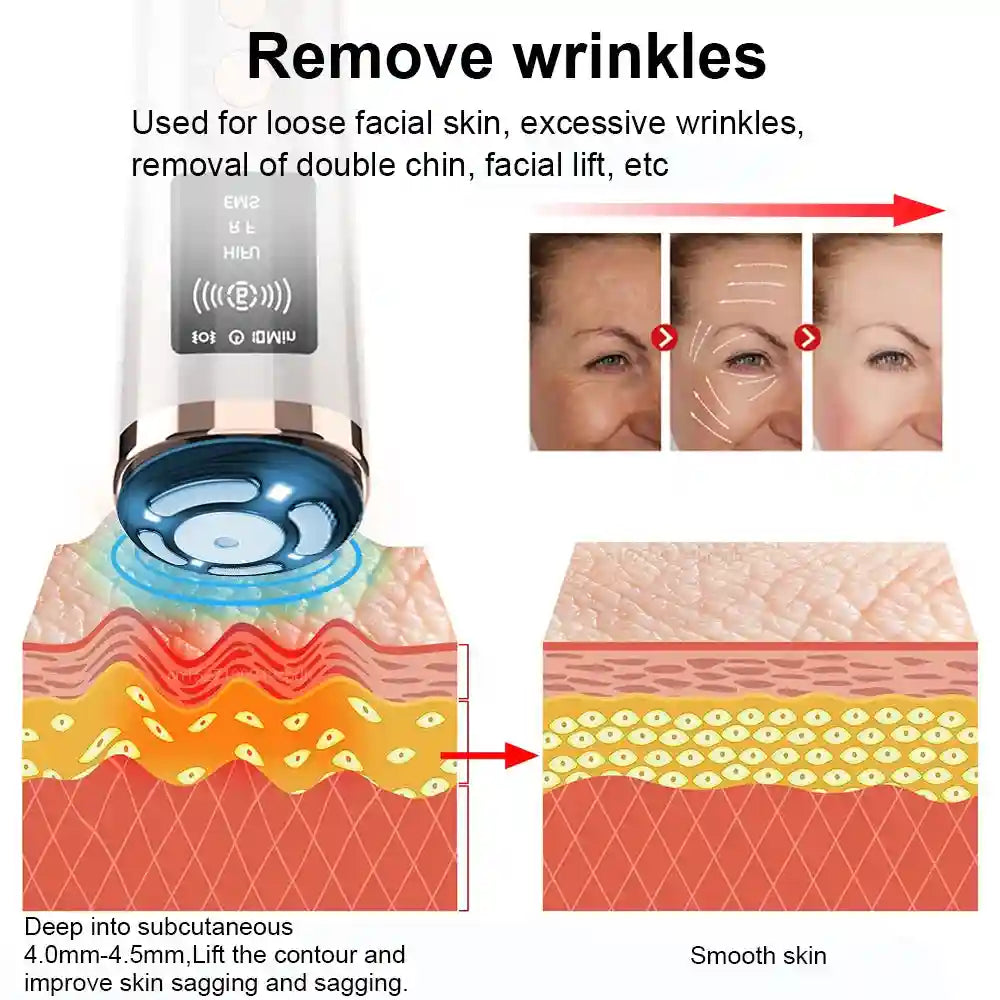 Hifu Face Lifting Machine | Microcurrent Skin Rejuvenation Tool Eye Massage Instrument Tidesmit