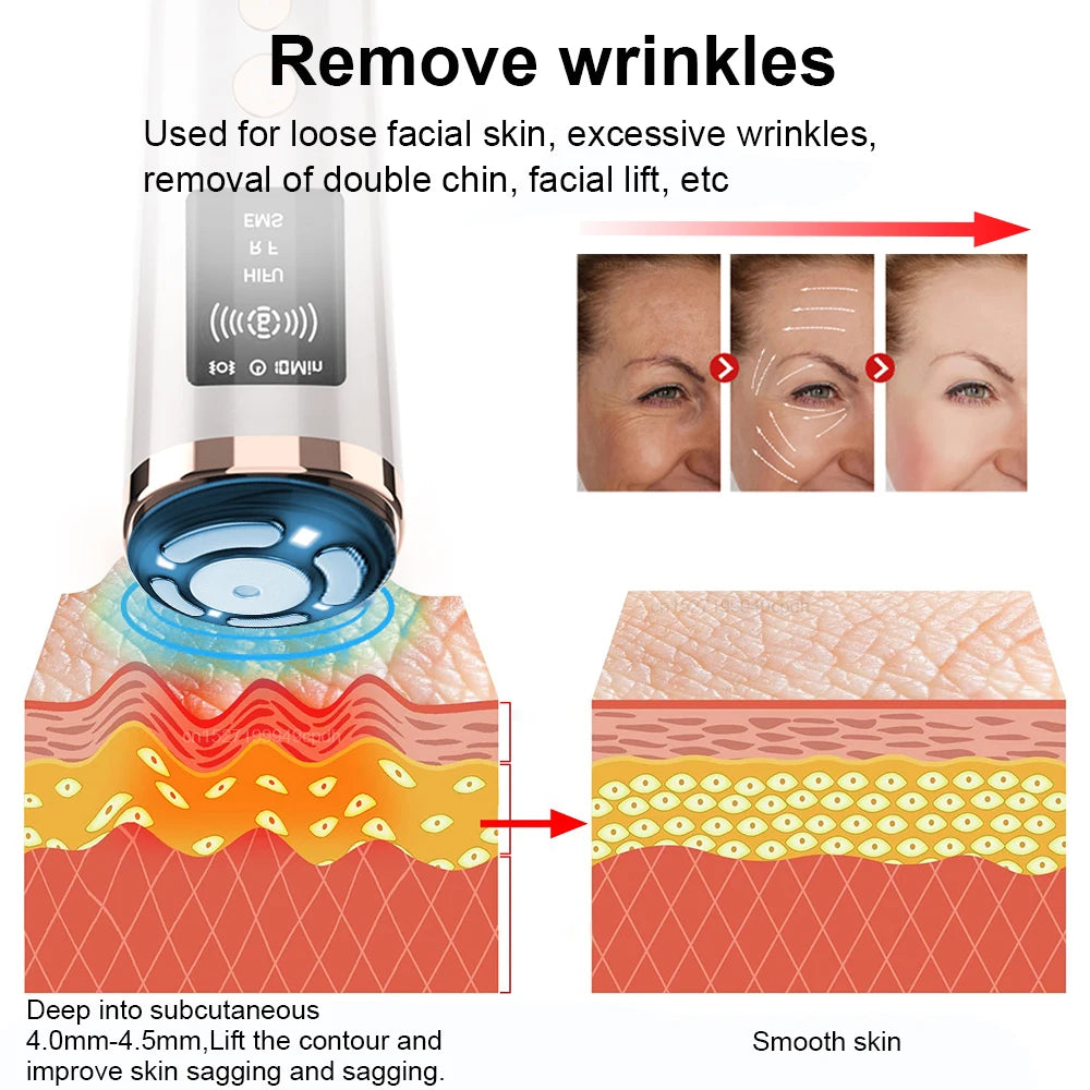 Mini HIFU face lifting machine with RF and EMS technology for anti-aging skin tightening and wrinkle reduction.