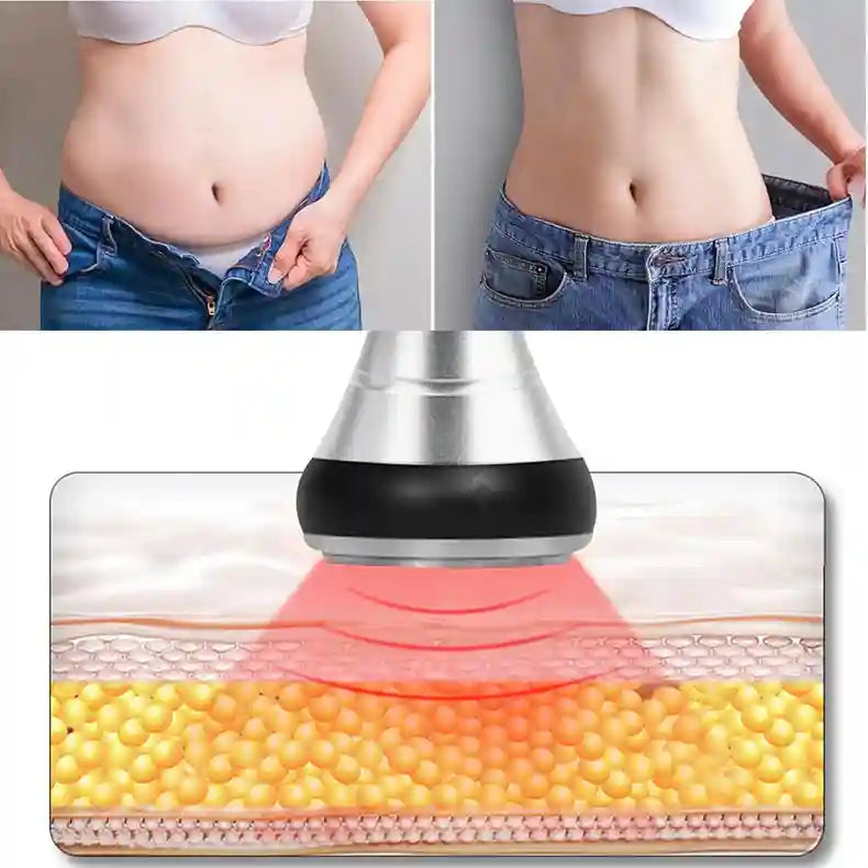 40K Cavitation Ultrasonic RF Slimming Device - Tidesmit EU Edition Eye Massage Instrument Tidesmit