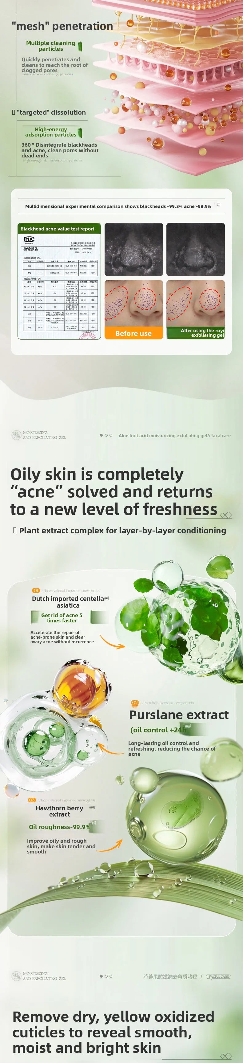 Aloe Vera Exfoliating Gel 300g - Professional Deep Pore Cleansing Face Scrub Scrubs Treatments Tidesmit