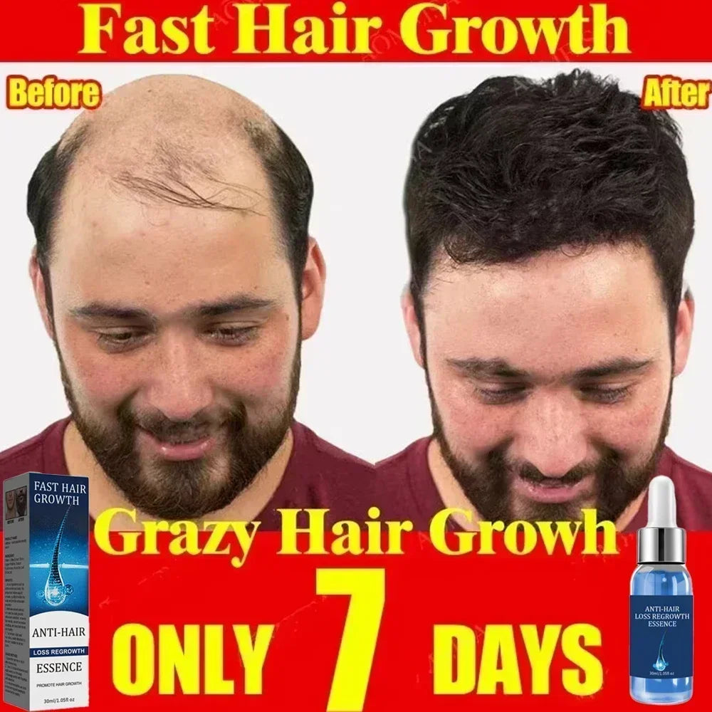 Hair Growth Treatment | Nourishing Scalp Serum for Natural Regrowth Scrubs Treatments Tidesmit