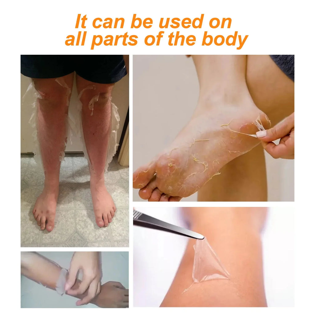 Strong Yellow Peeling Oil Bleach Dark Skin Whiten Lotion Lighten Body Elbow Knee Hand Exfoliate Dead Skin Nourish Even Skin Tone