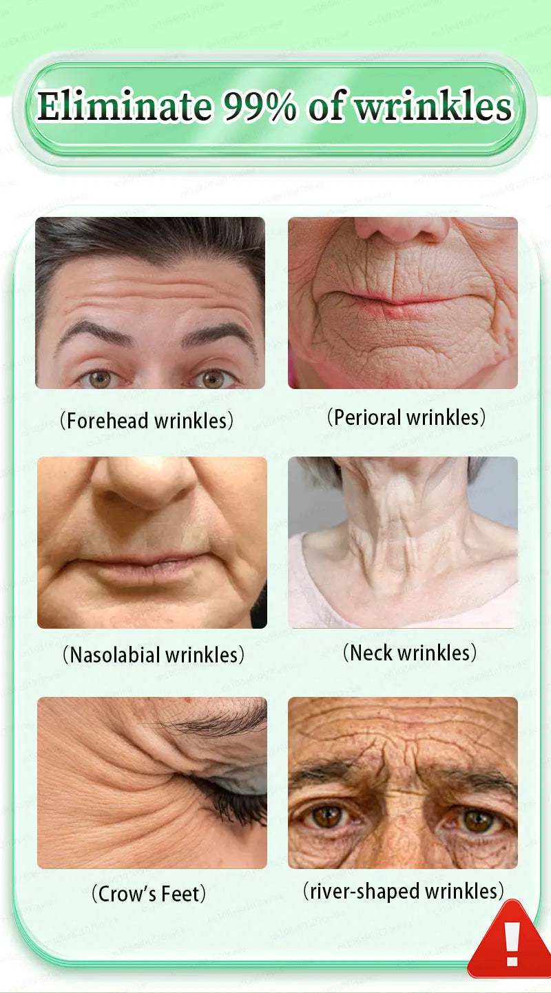 Tidesmit anti-wrinkle supplement to reduce forehead, perioral, and neck wrinkles for smoother, younger-looking skin.