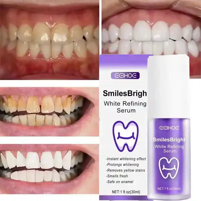 Tidesmit teeth whitening toothpaste gel for effective stain removal and fresh breath, 2025 Korean dental care formula