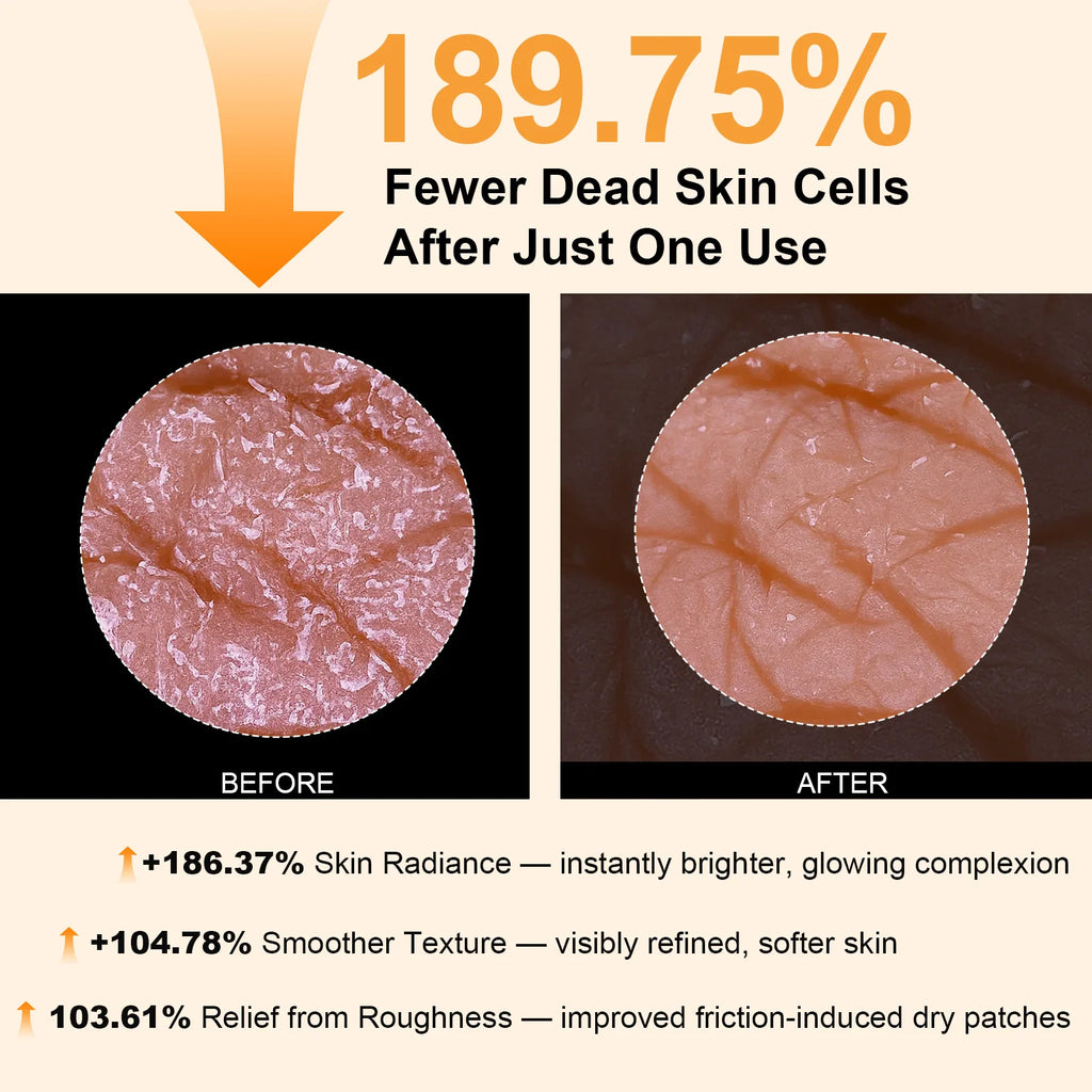 Body Keratin Care Kojic Acid Turmeric Spray Gently Exfoliating Peeling Solution Brightening Hydrating Skin Care All Skin Types