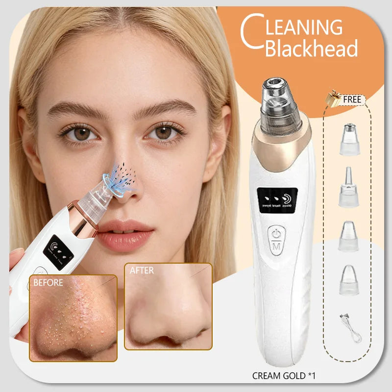 White and gold electric blackhead remover vacuum for facial pore cleansing with multiple suction heads and before-after.