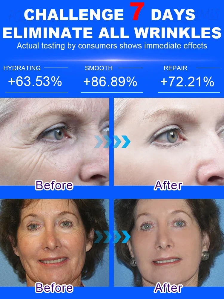 Tidesmit anti-wrinkle supplement before and after results: hydrating, skin smoothing, and cellular repair for firm skin.