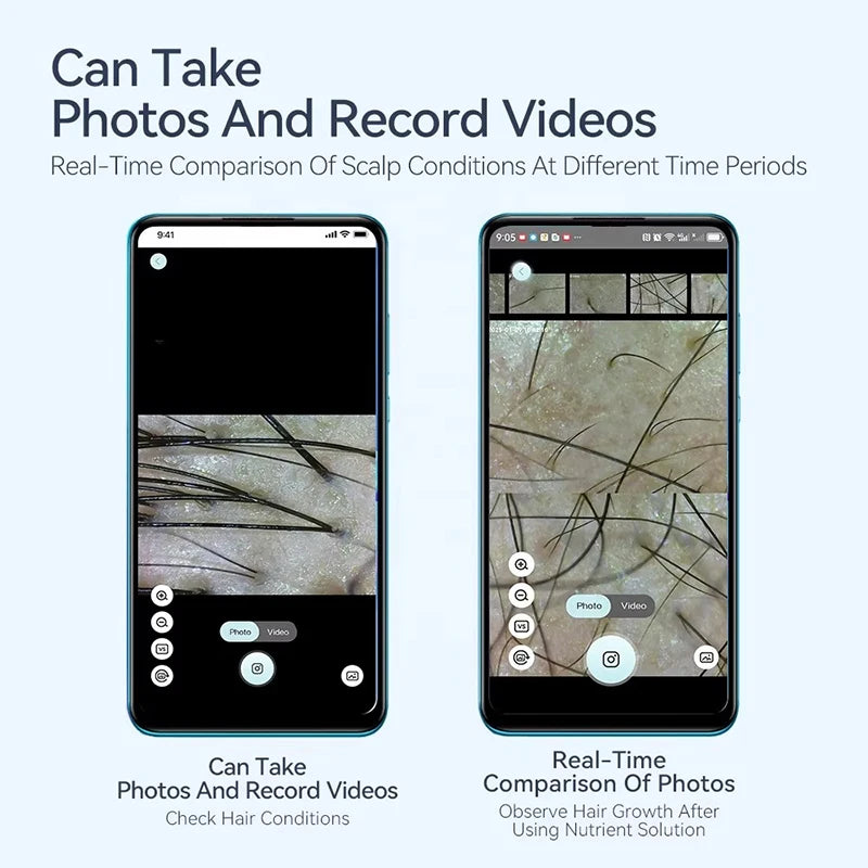 Two smartphones displaying a scalp analysis app for capturing photos and videos to compare hair growth over time.