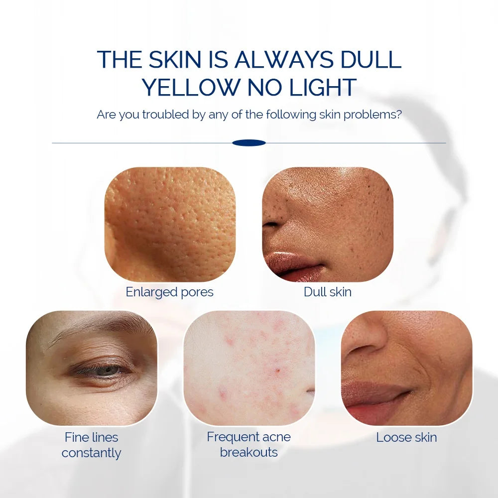 Close-up photos of skin concerns: enlarged pores, dullness, fine lines, acne breakouts, and loss of skin elasticity.