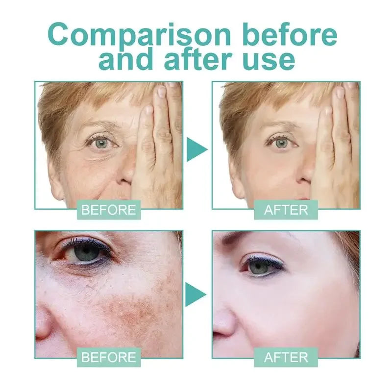 Dark Spot Corrector Cream for Pigmentation & PMU Aftercare | Tidesmit Permanent Makeup Machines Tidesmit
