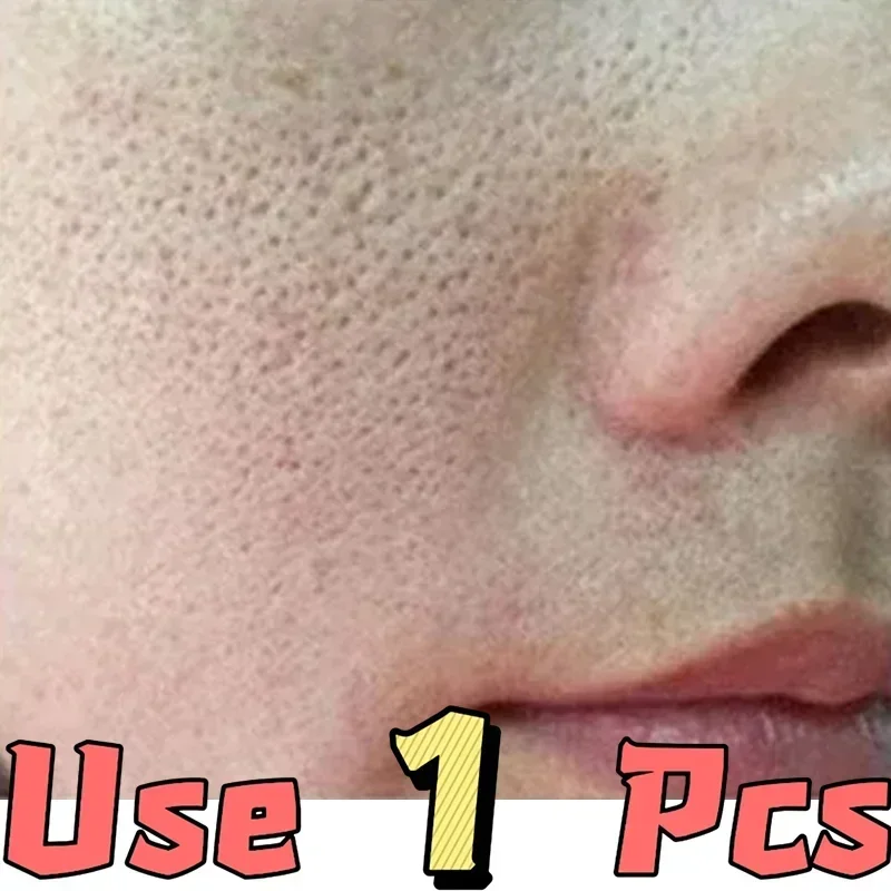 Close-up of skin texture showing enlarged pores around the nose and mouth, labeled for single-use application.